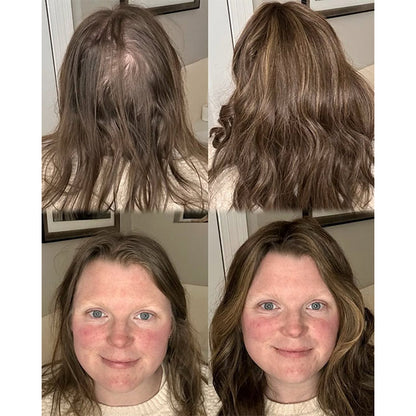 ⚡⚡ Final Hours –⚡2026 New Lightweight & Breathable Wavy Hair Topper