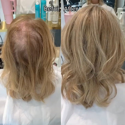 ⚡⚡ Final Hours –⚡2026 New Lightweight & Breathable Wavy Hair Topper